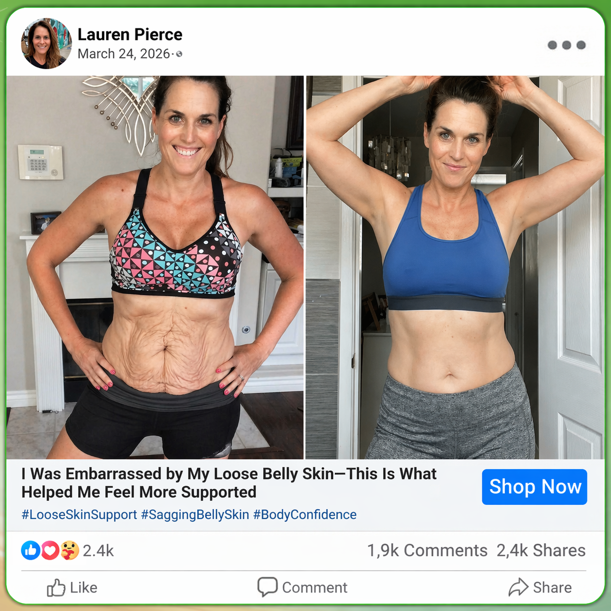 🇨🇦𝑶𝒇𝒇𝒊𝒄𝒊𝒂𝒍 𝑺𝒕𝒐𝒓𝒆  | 💯💯𝐂𝐚𝐫𝐞𝐔𝐩𝐥𝐢𝐟𝐭® 𝙈𝒐𝒓𝒊𝒏𝒈𝗮 · 𝗕𝗲𝗿𝗯𝐞𝐫𝐢𝐧𝙚 × 𝙉𝑨𝑫+ 𝟏𝟎-𝙞𝙣-𝟏 𝘼𝒅𝒗𝒂𝒏𝒄𝒆𝐝 𝐍𝐚𝐧𝙤 𝙈𝙞𝙘𝙧𝙤𝙣𝒆𝒆𝒅𝒍𝐞 𝐏𝐚𝐭𝙘𝙝(𝐉𝐮𝐬𝐭 𝐨𝐧𝐜𝐞 𝐚 𝐝𝐚𝐲, 𝐯𝐢𝐬𝐢𝐛𝐥𝐞 𝐜𝐡𝐚𝐧𝐠𝐞𝐬 𝐢𝐧 𝟕 𝐝𝐚𝐲𝐬） ✅ 𝐅𝐨𝐫 𝐨𝐛𝐞𝐬𝐢𝐭𝐲, 🅛🅞🅞🅢🅔 🅢🅚🅘🅝,𝐝𝐢𝐚𝐛𝐞𝐭𝐞𝐬, 𝐬𝐥𝐞𝐞𝐩 𝐚𝐩𝐧𝐞𝐚, 𝐣𝐨𝐢𝐧𝐭 𝐢𝐬𝐬𝐮𝐞𝐬, 𝐚𝐧𝐝 𝐦𝐨𝐫𝐞