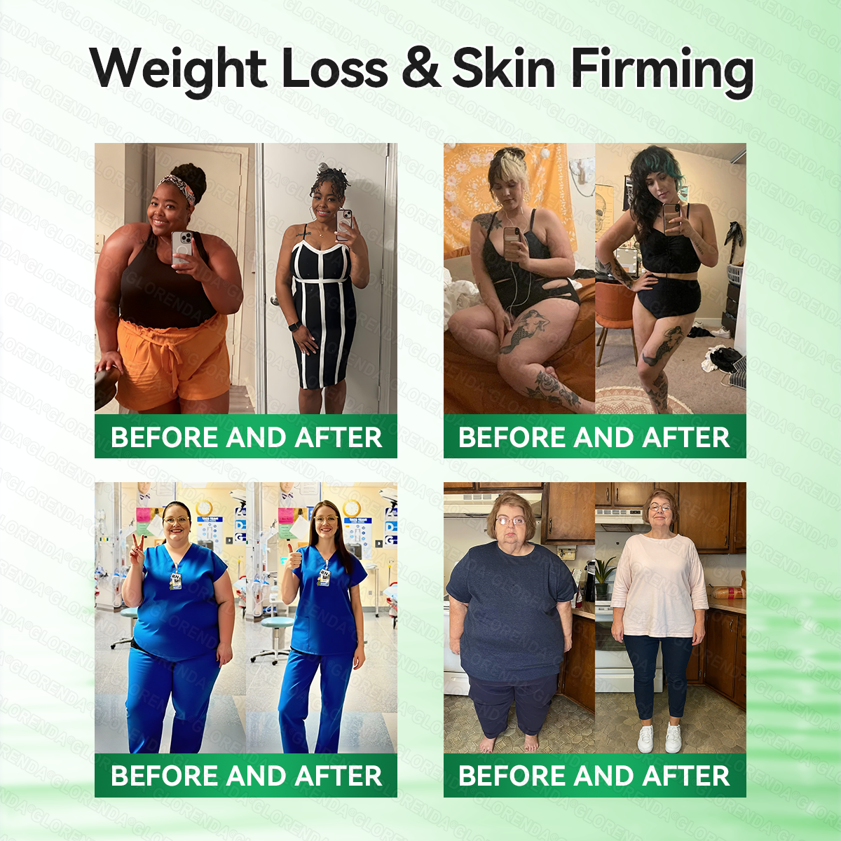 𝑶𝒇𝒇𝒊𝒄𝒊𝒂𝒍 𝑺𝒕𝒐𝒓𝒆  | 🍁🍁𝐂𝐚𝐫𝐞𝐔𝐩𝐥𝐢𝐟𝐭® 𝙈𝒐𝒓𝒊𝒏𝒈𝗮 · 𝗕𝗲𝗿𝗯𝐞𝐫𝐢𝐧𝙚 × 𝙉𝑨𝑫+ 𝟏𝟎-𝙞𝙣-𝟏 𝘼𝒅𝒗𝒂𝒏𝒄𝒆𝐝 𝐍𝐚𝐧𝙤 𝙈𝙞𝙘𝙧𝙤𝙣𝒆𝒆𝒅𝒍𝐞 𝐏𝐚𝐭𝙘𝙝(𝐉𝐮𝐬𝐭 𝐨𝐧𝐜𝐞 𝐚 𝐝𝐚𝐲, 𝐯𝐢𝐬𝐢𝐛𝐥𝐞 𝐜𝐡𝐚𝐧𝐠𝐞𝐬 𝐢𝐧 𝟕 𝐝𝐚𝐲𝐬） ✅ 𝐅𝐨𝐫 𝐨𝐛𝐞𝐬𝐢𝐭𝐲, 🅛🅞🅞🅢🅔 🅢🅚🅘🅝,𝐝𝐢𝐚𝐛𝐞𝐭𝐞𝐬, 𝐬𝐥𝐞𝐞𝐩 𝐚𝐩𝐧𝐞𝐚, 𝐣𝐨𝐢𝐧𝐭 𝐢𝐬𝐬𝐮𝐞𝐬, 𝐚𝐧𝐝 𝐦𝐨𝐫𝐞