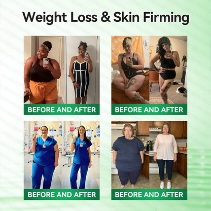 𝑶𝒇𝒇𝒊𝒄𝒊𝒂𝒍 𝑺𝒕𝒐𝒓𝒆  | 🍁🍁𝐂𝐚𝐫𝐞𝐔𝐩𝐥𝐢𝐟𝐭® 𝙈𝒐𝒓𝒊𝒏𝒈𝗮 · 𝗕𝗲𝗿𝗯𝐞𝐫𝐢𝐧𝙚 × 𝙉𝑨𝑫+ 𝟏𝟎-𝙞𝙣-𝟏 𝘼𝒅𝒗𝒂𝒏𝒄𝒆𝐝 𝐍𝐚𝐧𝙤 𝙈𝙞𝙘𝙧𝙤𝙣𝒆𝒆𝒅𝒍𝐞 𝐏𝐚𝐭𝙘𝙝(𝐉𝐮𝐬𝐭 𝐨𝐧𝐜𝐞 𝐚 𝐝𝐚𝐲, 𝐯𝐢𝐬𝐢𝐛𝐥𝐞 𝐜𝐡𝐚𝐧𝐠𝐞𝐬 𝐢𝐧 𝟕 𝐝𝐚𝐲𝐬） ✅ 𝐅𝐨𝐫 𝐨𝐛𝐞𝐬𝐢𝐭𝐲, 🅛🅞🅞🅢🅔 🅢🅚🅘🅝,𝐝𝐢𝐚𝐛𝐞𝐭𝐞𝐬, 𝐬𝐥𝐞𝐞𝐩 𝐚𝐩𝐧𝐞𝐚, 𝐣𝐨𝐢𝐧𝐭 𝐢𝐬𝐬𝐮𝐞𝐬, 𝐚𝐧𝐝 𝐦𝐨𝐫𝐞