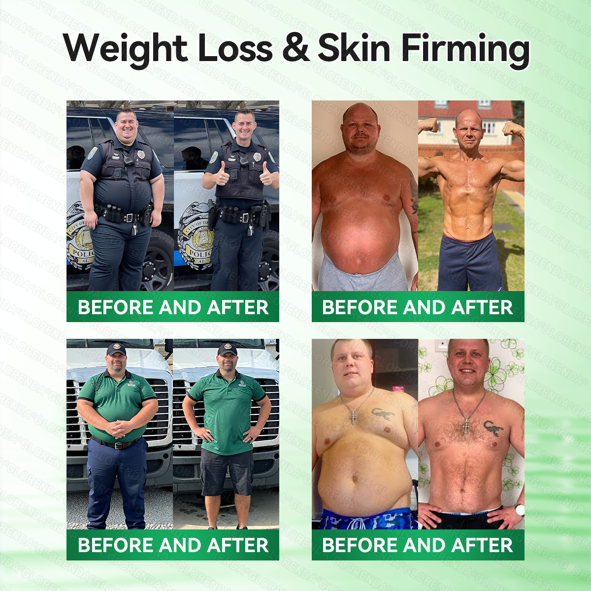 𝑶𝒇𝒇𝒊𝒄𝒊𝒂𝒍 𝑺𝒕𝒐𝒓𝒆  | 🍁🍁𝐂𝐚𝐫𝐞𝐔𝐩𝐥𝐢𝐟𝐭® 𝙈𝒐𝒓𝒊𝒏𝒈𝗮 · 𝗕𝗲𝗿𝗯𝐞𝐫𝐢𝐧𝙚 × 𝙉𝑨𝑫+ 𝟏𝟎-𝙞𝙣-𝟏 𝘼𝒅𝒗𝒂𝒏𝒄𝒆𝐝 𝐍𝐚𝐧𝙤 𝙈𝙞𝙘𝙧𝙤𝙣𝒆𝒆𝒅𝒍𝐞 𝐏𝐚𝐭𝙘𝙝(𝐉𝐮𝐬𝐭 𝐨𝐧𝐜𝐞 𝐚 𝐝𝐚𝐲, 𝐯𝐢𝐬𝐢𝐛𝐥𝐞 𝐜𝐡𝐚𝐧𝐠𝐞𝐬 𝐢𝐧 𝟕 𝐝𝐚𝐲𝐬） ✅ 𝐅𝐨𝐫 𝐨𝐛𝐞𝐬𝐢𝐭𝐲, 🅛🅞🅞🅢🅔 🅢🅚🅘🅝,𝐝𝐢𝐚𝐛𝐞𝐭𝐞𝐬, 𝐬𝐥𝐞𝐞𝐩 𝐚𝐩𝐧𝐞𝐚, 𝐣𝐨𝐢𝐧𝐭 𝐢𝐬𝐬𝐮𝐞𝐬, 𝐚𝐧𝐝 𝐦𝐨𝐫𝐞