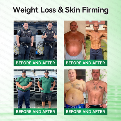 𝑶𝒇𝒇𝒊𝒄𝒊𝒂𝒍 𝑺𝒕𝒐𝒓𝒆  | 🍁🍁𝐂𝐚𝐫𝐞𝐔𝐩𝐥𝐢𝐟𝐭® 𝙈𝒐𝒓𝒊𝒏𝒈𝗮 · 𝗕𝗲𝗿𝗯𝐞𝐫𝐢𝐧𝙚 × 𝙉𝑨𝑫+ 𝟏𝟎-𝙞𝙣-𝟏 𝘼𝒅𝒗𝒂𝒏𝒄𝒆𝐝 𝐍𝐚𝐧𝙤 𝙈𝙞𝙘𝙧𝙤𝙣𝒆𝒆𝒅𝒍𝐞 𝐏𝐚𝐭𝙘𝙝(𝐉𝐮𝐬𝐭 𝐨𝐧𝐜𝐞 𝐚 𝐝𝐚𝐲, 𝐯𝐢𝐬𝐢𝐛𝐥𝐞 𝐜𝐡𝐚𝐧𝐠𝐞𝐬 𝐢𝐧 𝟕 𝐝𝐚𝐲𝐬） ✅ 𝐅𝐨𝐫 𝐨𝐛𝐞𝐬𝐢𝐭𝐲, 🅛🅞🅞🅢🅔 🅢🅚🅘🅝,𝐝𝐢𝐚𝐛𝐞𝐭𝐞𝐬, 𝐬𝐥𝐞𝐞𝐩 𝐚𝐩𝐧𝐞𝐚, 𝐣𝐨𝐢𝐧𝐭 𝐢𝐬𝐬𝐮𝐞𝐬, 𝐚𝐧𝐝 𝐦𝐨𝐫𝐞